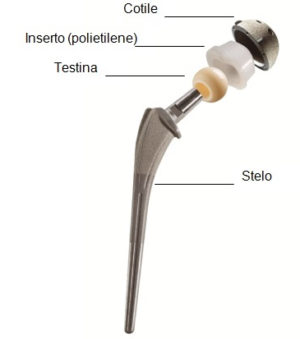 materiali protesi anca