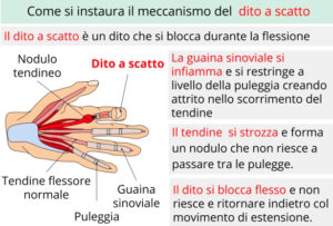 dito-a-scatto